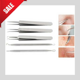 Blackhead And Comedone Extractor-Limited Quantity