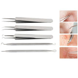 Blackhead And Comedone Extractor-Limited Quantity