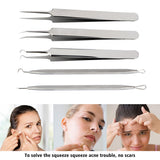 Blackhead And Comedone Extractor-Limited Quantity